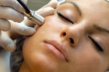 microdermabrasion-1A